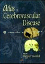 Atlas of Cerebrovascular Disease image