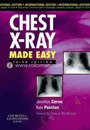 Chest X-Ray Made Easy image