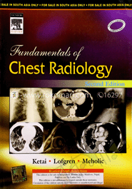 Fundamentals of Chest Radiology image
