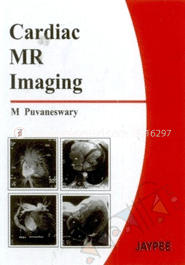Cardiac MR Imaging image