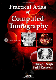 Practical Atlas of Computed Tomography image