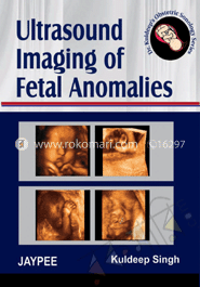 Ultrasound Imaging of Fetal Anomalies image