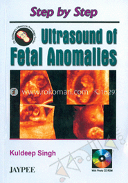 Step by Step Ultrasound of Fetal Anomalies image