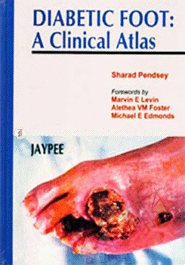 Diabetic Foot: A Clinical Atlas image