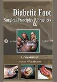 Diabetic Foot: Surgical Principles and Practices image