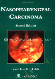 Nasopharyngeal Carcinoma image