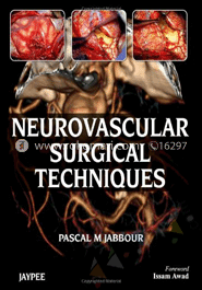 Neurovascular Surgical Techniques image