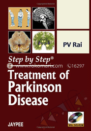 Step By Step Treatment Of Parkinson Disease image