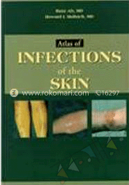 Atlas Of Infections Of The Skin 
