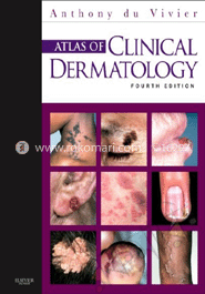 Atlas Of Clinical Dermatology 
