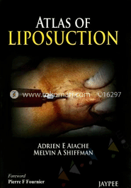 Atlas of Liposuction image