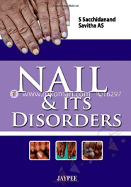 Nail and Its Disorders image