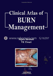 Clinical Atlas Of Burn Management image