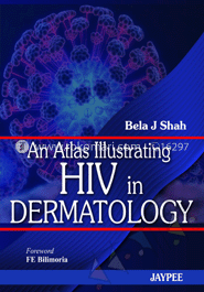 An Atlas Illustrated HIV in Dermatology image