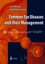 Common Eye Diseases and their Management image