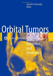 Orbital Tumors: Diagnosis and Treatment image