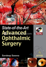 State-Of-The-Art Advanced Ophthalmic Surgery image