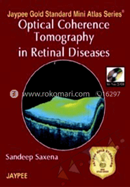 Optical Coherence Tomography In Retinal Diseases image