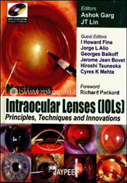 Mastering Intraocular Lenses (Iols) image