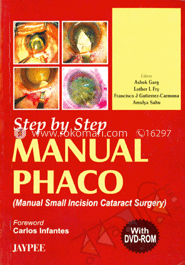 Step By Step Manual Phaco image