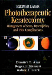 Excimer Laser Phototherapeutic Keratectomy: Phototherapeutic Keratectomy image