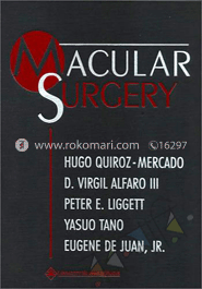Macular Surgery image