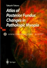 Atlas Of Posterior Fundus Changes In Pathologic Myopia image
