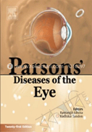 Parsons Disease Of The Eye image