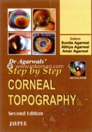 Step By Step Corneal Topography image