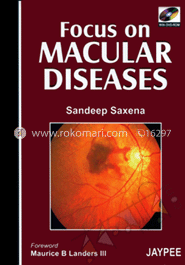 Focus On Macular Diseases (with DVD Rom) image