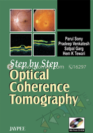 Step By Step Optical Coherence Tomography image