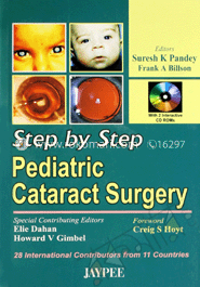 Step By Step Pediatric Cataract Surgery 