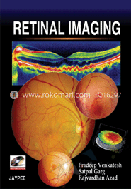 Retinal Imaging image