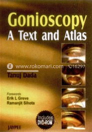 Gonioscopy: A Text and Atlas image