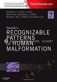 Smith's Recognizable Patterns of Human Malformation image