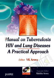 Manual on Tuberculosis HIV and Lung Diseases: A Practical Approach image