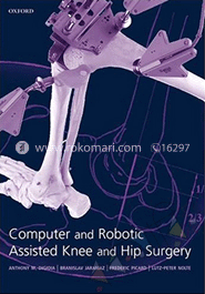 Computer And Robotic Assisted Hip And Knee Surgery image