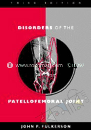 Disorders of the Patellofemoral Joint image