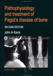 Pathophysiology and Treatment of Paget's Disease of Bone image