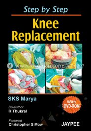 Step by Step Knee Replacement (With DVD-ROM) 