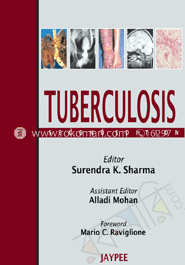 Tuberculosis image