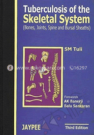 Tuberculosis of the Skeletal System image