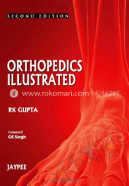 Orthopedics Illustrated image