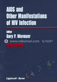 Aids and Other Manifestations Of HIV Infection image