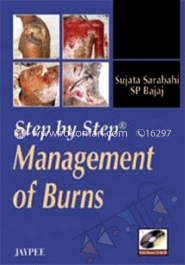 Step by Step Management of Burns  image