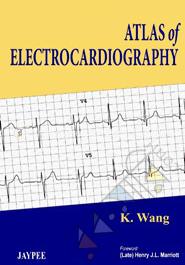 Atlas Of Electrocardiography image