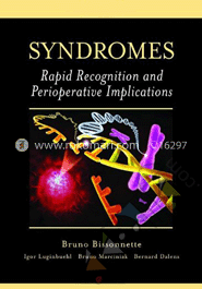 Syndromes: Rapid Recognition and Perioperative Implications image