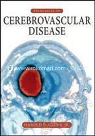 Principles of Cerebrovascular Disease image