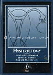 Hysterectomy image