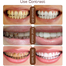 Aichun Beauty 24K Gold Whitening Toothpaste - 100ml image